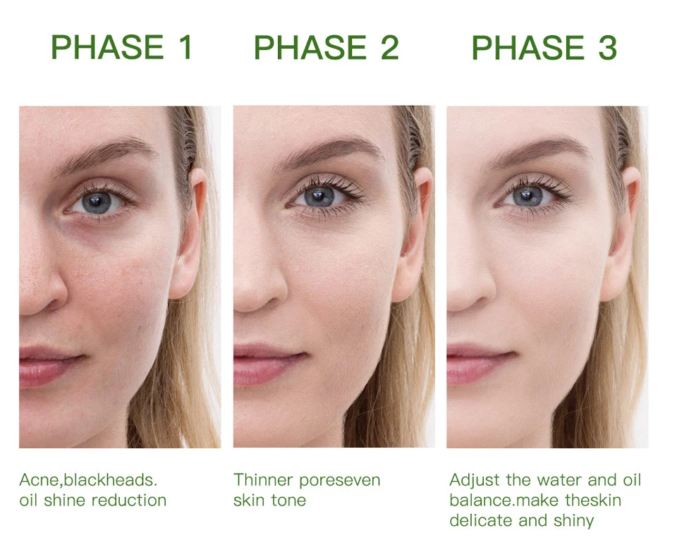 Green Tea Cooling Cleansing Mud Mask for Deep Pore Cleaning and Blackhead Removal - 100g 6 green tea cooling cleansing mud mask lak 5m89phgv desc 6