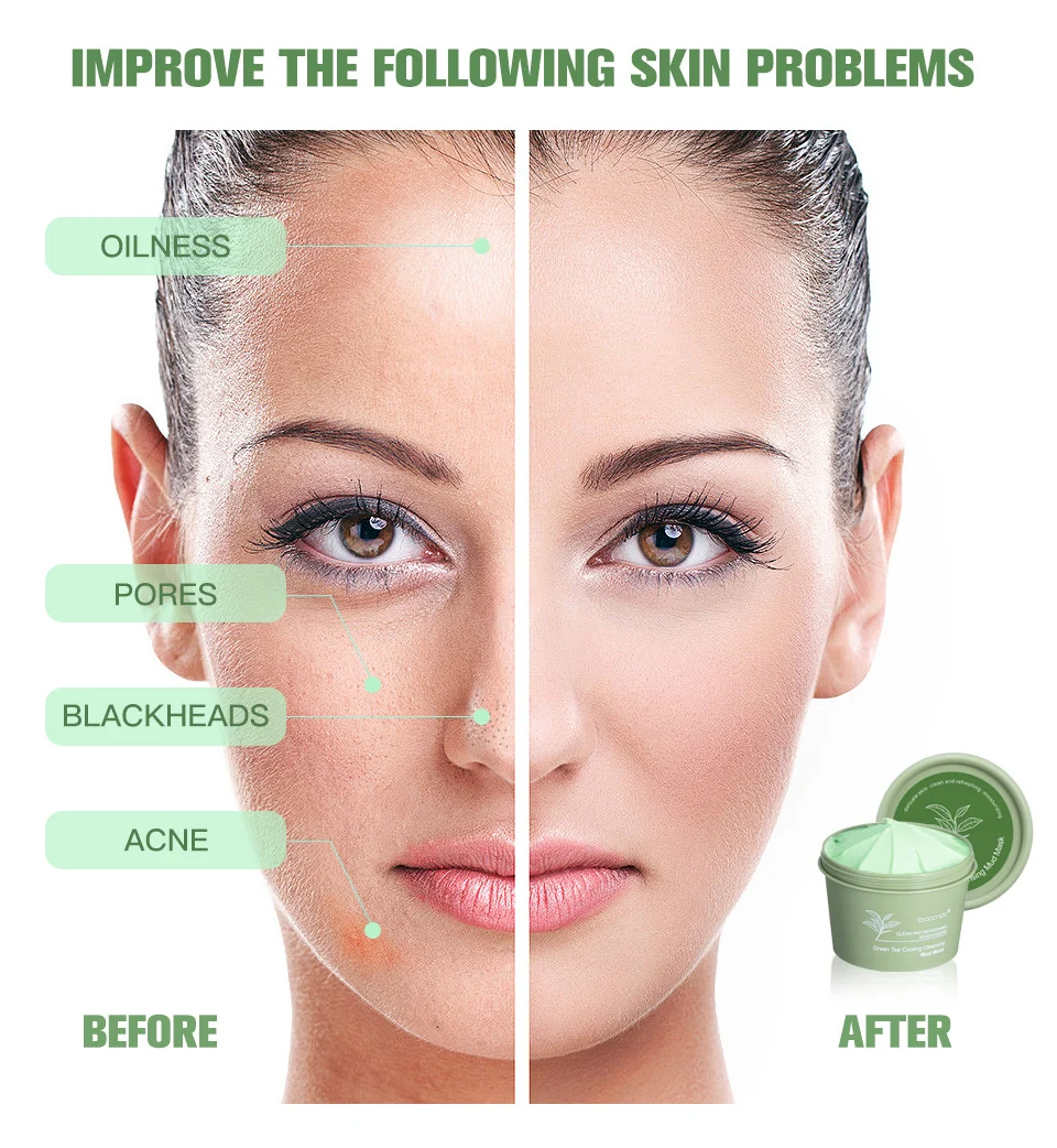 Green Tea Cooling Cleansing Mud Mask for Deep Pore Cleaning and Blackhead Removal - 100g 7 green tea cooling cleansing mud mask lak 5m89phgv desc 7